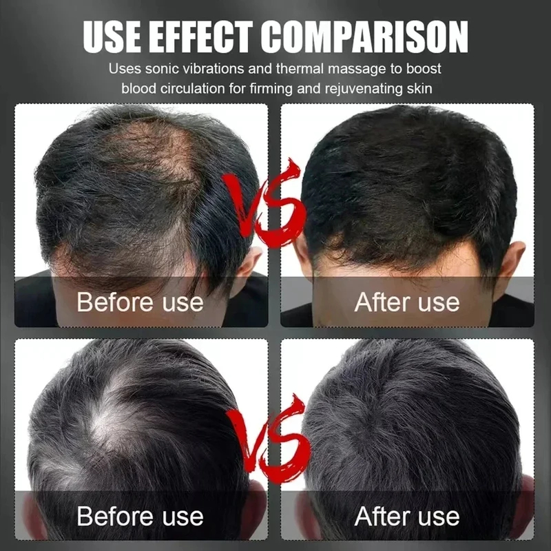 قبعة علاج الشعر بالضوء الأحمر  - مراجعة Hair Care For Hair Loss وسعره